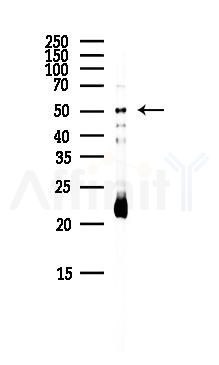 NK1R Antibody - Western blot analysis of lysates from Mouse liver, using NK1R Antibody at 1/1000 dilution.