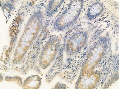 OR10C1 Antibody - DF5006 at 1/100 staining human normal colon tissue by IHC-P.