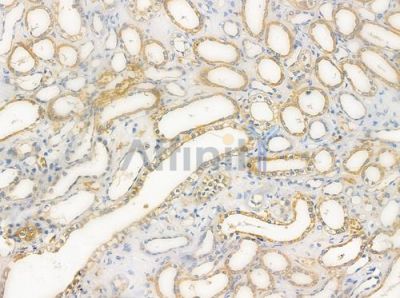 OR2AJ1 Antibody - DF5014 at 1/100 staining human normal kidney tissue by IHC-P.