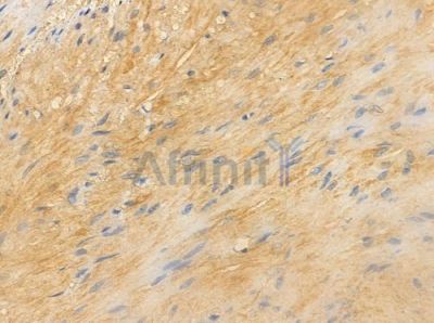 OR2T11 Antibody - DF5016 at 1/100 staining human normal colon tissue by IHC-P.
