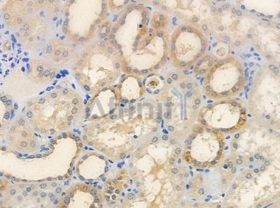 OR2T11 Antibody - DF5016 at 1/100 staining human normal kidney tissue by IHC-P.