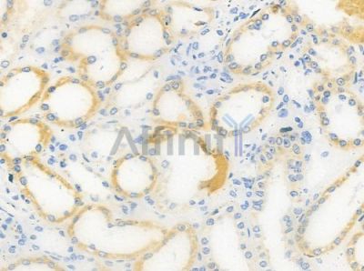 OR4A15 Antibody - DF5083 at 1/100 staining human normal kidney tissue by IHC-P.
