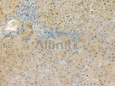 OR4C13 Antibody - DF5088 at 1/100 staining human normal liver tissue by IHC-P.