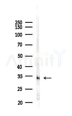 OR4F4 Antibody - Western blot analysis of lysates from EC304 cells(UV,30min treatment), using OR4F4 Antibody at 1/1000 dilution.
