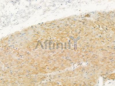 OR8G1 Antibody - DF5126 at 1/100 staining human normal gastric tissue by IHC-P.