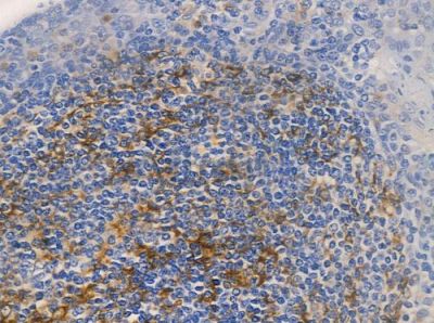 OR8G1 Antibody - DF5126 at 1/100 staining human normal tonsil tissue by IHC-P.