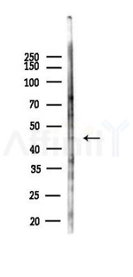 PEVR1 Antibody - Western blot analysis of lysates from 293 cells(heat-shock,45min treatment), using PEVR1 Antibody at 1/1000 dilution.