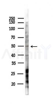 GPRC5A Antibody - Western blot analysis of lysates from 293 cells(heat-shock,45min treatment), using GPRC5A Antibody at 1/1000 dilution.