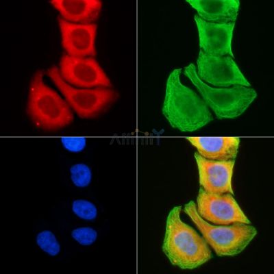 TMEM145 Antibody - DF5168 staining Hela cells(30min of UV treatment) by IF/ICC.