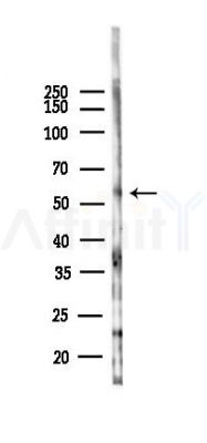 TMEM145 Antibody - Western blot analysis of lysates from 293 cells(heat-shock,45min treatment), using TMEM145 Antibody at 1/1000 dilution.