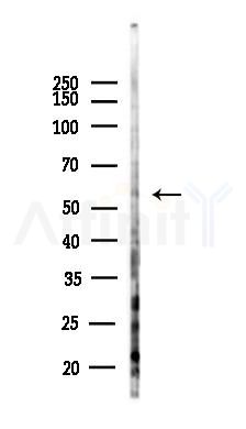 TMEM145 Antibody - Western blot analysis of lysates from Hela cells(heat-shock,45min treatment), using TMEM145 Antibody at 1/1000 dilution.