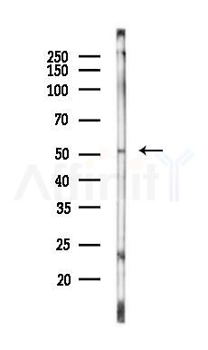VIP Receptor 1 Antibody - Western blot analysis of lysates from Rat liver, using VIP Receptor 1 Antibody at 1/1000 dilution.