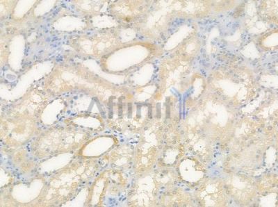 VN1R4 Antibody - DF5175 at 1/100 staining human normal kidney tissue by IHC-P.
