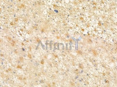 OR51H1 Antibody - DF5190 at 1/100 staining human astrocytoma by IHC-P.