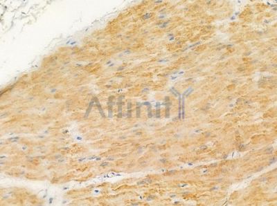 OR5D16 Antibody - DF5204 at 1/100 staining human normal gastric tissue by IHC-P.