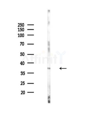 U12 Antibody - Western blot analysis of lysates from EC304 cells(LPS,4h treatment), using U12 Antibody at 1/1000 dilution.