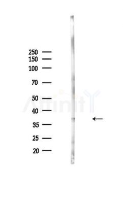 U12 Antibody - Western blot analysis of lysates from MDA-MB-231 cells(heat-shock,45min treatment), using U12 Antibody at 1/1000 dilution.