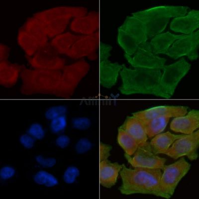 U12 Antibody - DF5216 staining Hela cells(30min of UV treatment) by IF/ICC.