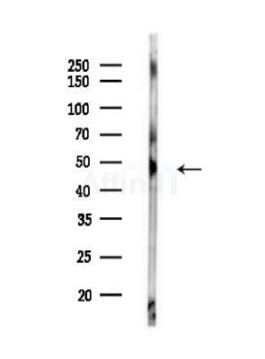 US28 Antibody - Western blot analysis of lysates from MCF7 cells(heat-shock,45min treatment), using US28 Antibody at 1/1000 dilution.