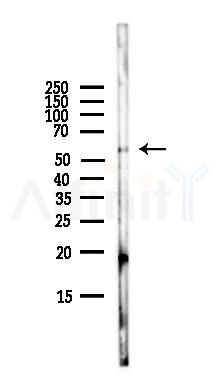 APG5L/ATG5 Antibody - Western blot analysis of lysates from HepG2 cells(LPS,4h treatment), using APG5L/ATG5 Antibody at 1/1000 dilution.