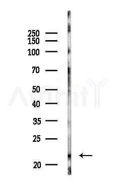 BID Antibody - Western blot analysis of lysates from COLO205 cells(heat-shock,45min treatment), using BID Antibody at 1/1000 dilution.