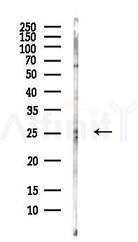 CRP Antibody - Western blot analysis of lysates from PC12 cells(LPS, 4h treatment), using CRP Antibody at 1/1000 dilution.