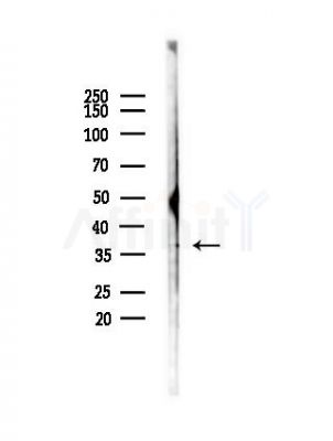 DOK4 Antibody - Western blot analysis of lysates from HepG2 cells(heat-shock,45min treatment), using DOK4 Antibody at 1/1000 dilution.