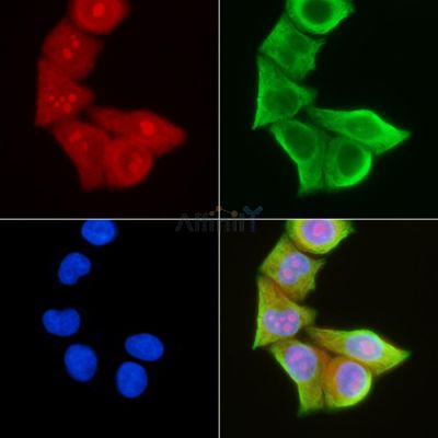 DOK4 Antibody - DF6029 staining Hela cells(30min of UV treatment) by IF/ICC.