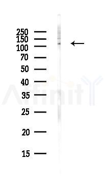 SirT1 Antibody - Western blot analysis of lysates from PC12 cells(LPS, 4h treatment), using SirT1 Antibody at 1/1000 dilution.