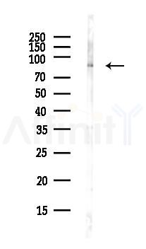 SirT1 Antibody - Western blot analysis of lysates from COLO205 cells(heat-shock,45min treatment), using SirT1 Antibody at 1/1000 dilution.