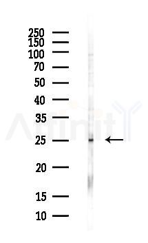 Interferon gamma Antibody - Western blot analysis of lysates from PC12 cells(LPS, 4h treatment), using Interferon gamma Antibody at 1/1000 dilution.