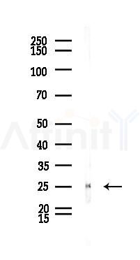 Interferon gamma Antibody - Western blot analysis of lysates from Rat liver, using Interferon gamma Antibody at 1/1000 dilution.