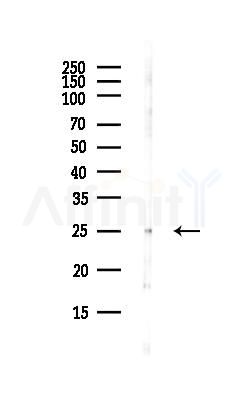 Interferon gamma Antibody - Western blot analysis of lysates from COLO205 cells(heat-shock,45min treatment), using Interferon gamma Antibody at 1/1000 dilution.