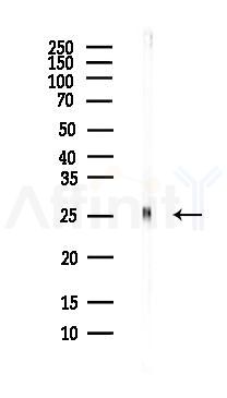 Interferon gamma Antibody - Western blot analysis of lysates from Mouse brain, using Interferon gamma Antibody at 1/1000 dilution.