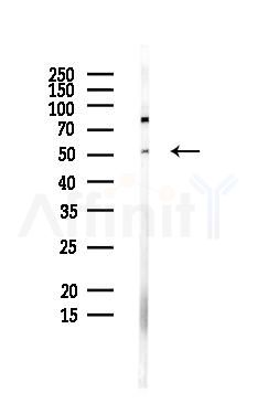 NAMPT Antibody - Western blot analysis of lysates from PC12 cells(LPS, 4h treatment), using NAMPT Antibody at 1/1000 dilution.