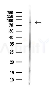 NEFL Antibody - Western blot analysis of lysates from PC12 cells(LPS, 4h treatment), using NEFL Antibody at 1/1000 dilution.