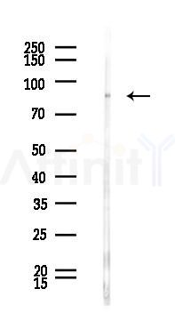 NEFL Antibody - Western blot analysis of lysates from Rat liver, using NEFL Antibody at 1/1000 dilution.