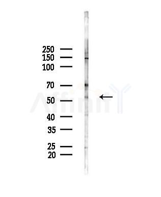 OLFM1 Antibody - Western blot analysis of lysates from A375 cells(heat-shock,45min treatment), using OLFM1 Antibody at 1/1000 dilution.