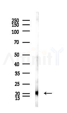 SOD1 Antibody - Western blot analysis of lysates from Rat liver, using SOD1 Antibody at 1/1000 dilution.