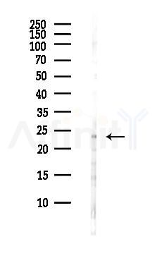 Bim Antibody - Western blot analysis of lysates from COLO205 cells(heat-shock,45min treatment), using Bim Antibody at 1/1000 dilution.