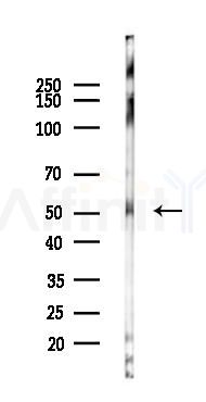 Retinoic Acid Receptor alpha Antibody - Western blot analysis of lysates from B16F10-LUC cells(starvation,24h treatment), using Retinoic Acid Receptor alpha Antibody at 1/1000 dilution.