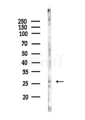 VHL Antibody - Western blot analysis of lysates from HepG2 cells(starvation,24h treatment), using VHL Antibody at 1/1000 dilution.