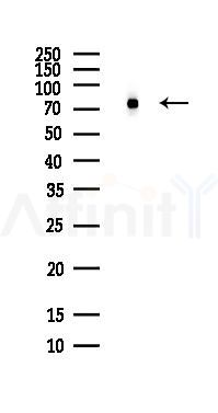 Grp75 Antibody - Western blot analysis of lysates from PC12 cells(LPS, 4h treatment), using Grp75 Antibody at 1/1000 dilution.