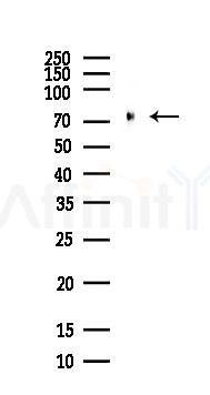 Grp75 Antibody - Western blot analysis of lysates from COLO205 cells(heat-shock,45min treatment), using Grp75 Antibody at 1/1000 dilution.