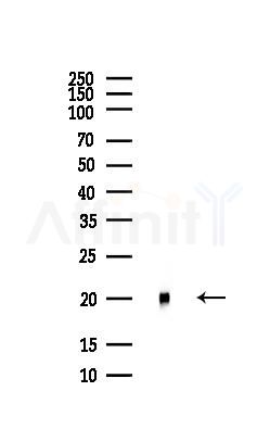 PEBP1 Antibody - Western blot analysis of lysates from COLO205 cells(heat-shock,45min treatment), using PEBP1 Antibody at 1/1000 dilution.