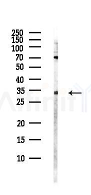 NRG1 Antibody - Western blot analysis of lysates from PC12 cells(LPS, 4h treatment), using NRG1 Antibody at 1/1000 dilution.