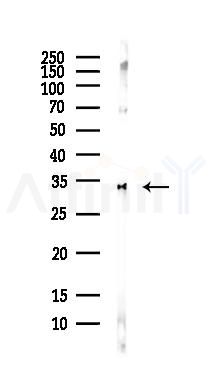 NRG1 Antibody - Western blot analysis of lysates from COLO205 cells(heat-shock,45min treatment), using NRG1 Antibody at 1/1000 dilution.