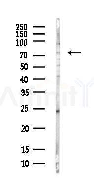 ATG7 Antibody - Western blot analysis of lysates from COLO205 cells(heat-shock,45min treatment), using ATG7 Antibody at 1/1000 dilution.
