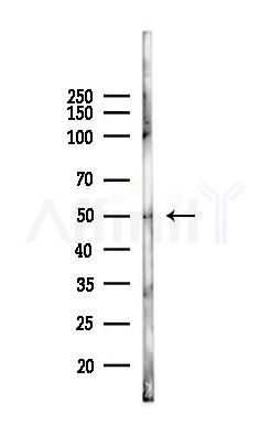 P4HB Antibody - Western blot analysis of lysates from COLO205 cells(heat-shock,45min treatment), using P4HB Antibody at 1/1000 dilution.