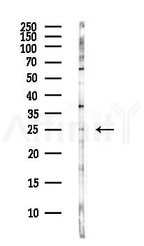 SOCS3 Antibody - Western blot analysis of lysates from COLO205 cells(heat-shock,45min treatment), using SOCS3 Antibody at 1/1000 dilution.